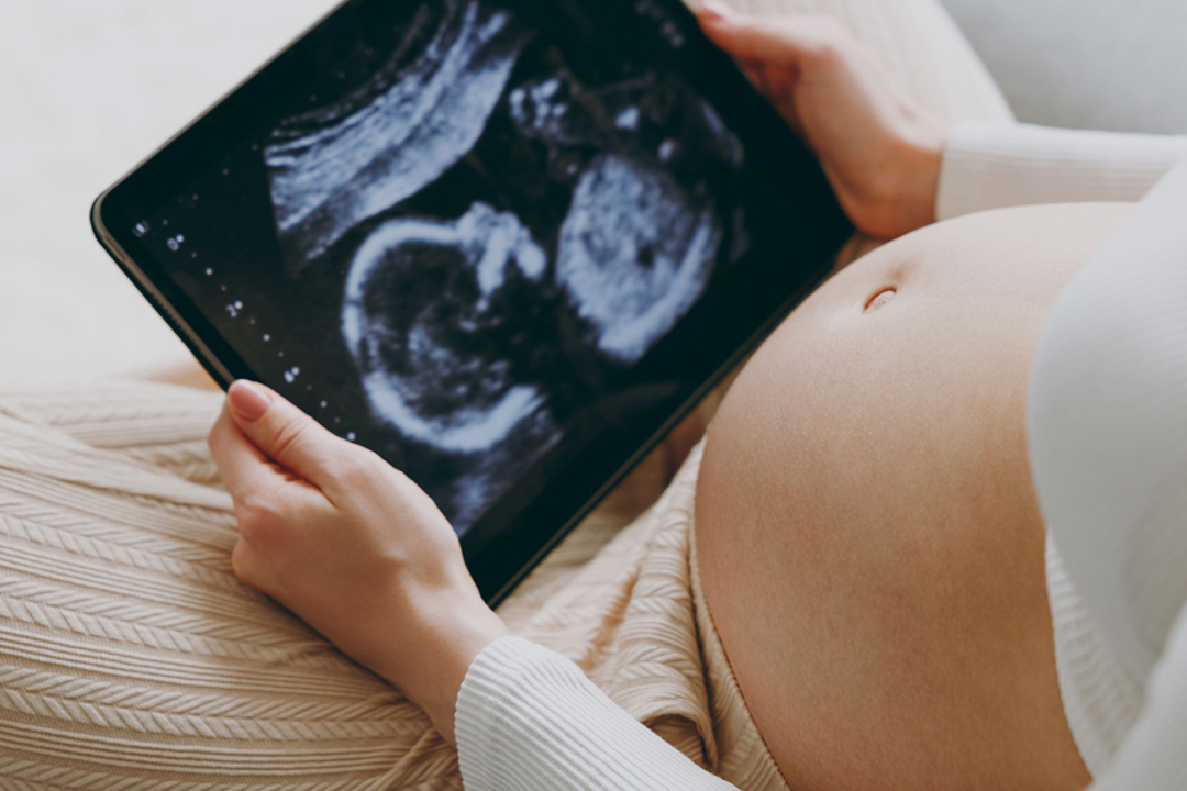 Team-Based Care Guides a Pregnancy Through Breast Cancer